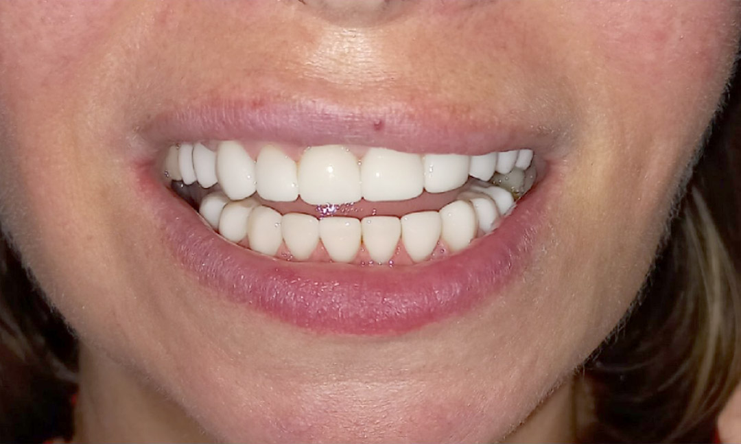 Image after