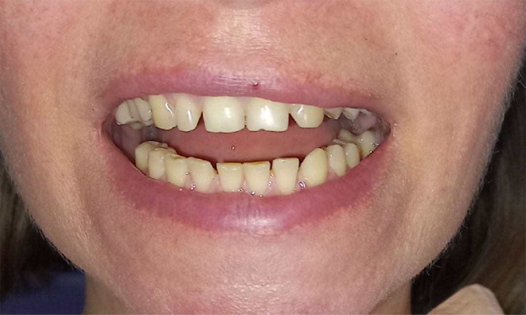 Image before