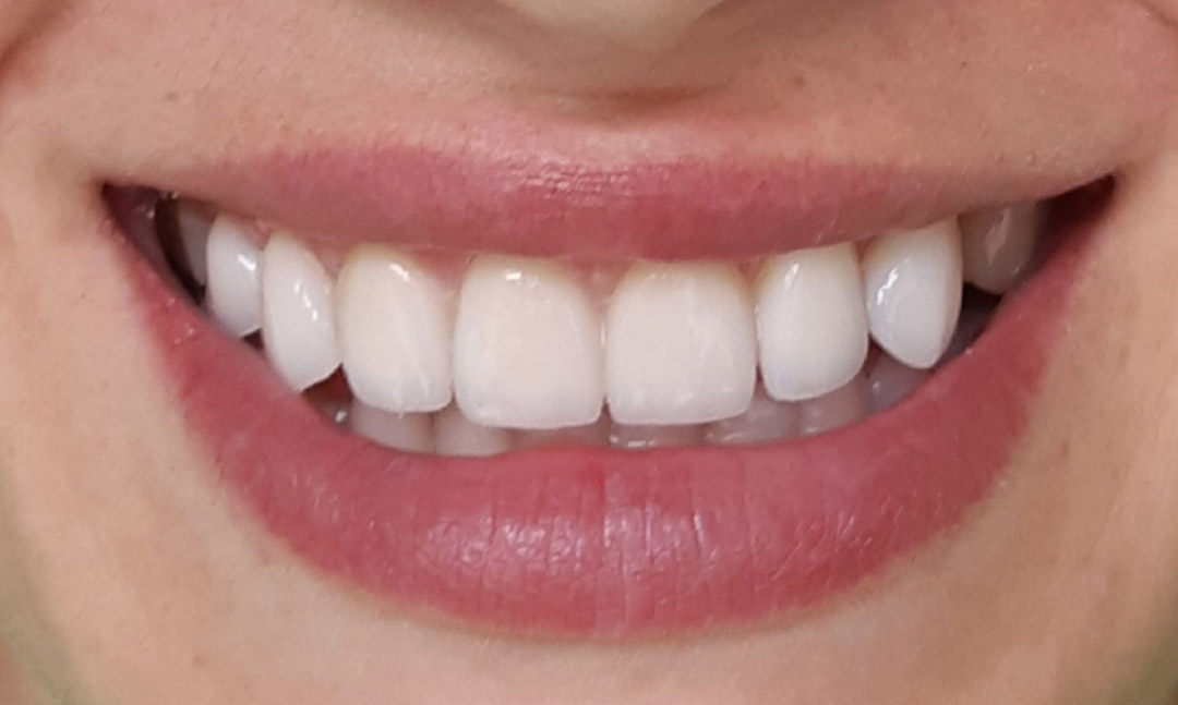 Image after