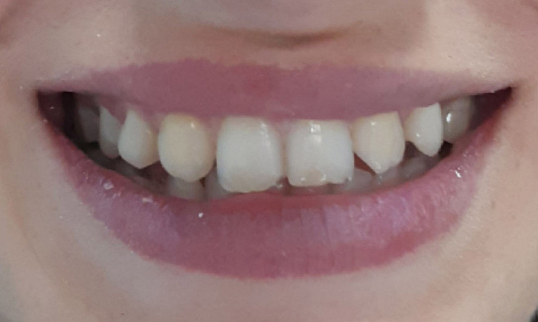 Image before