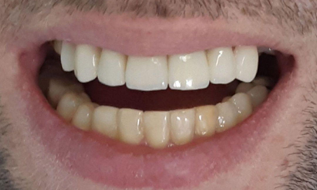 Image after