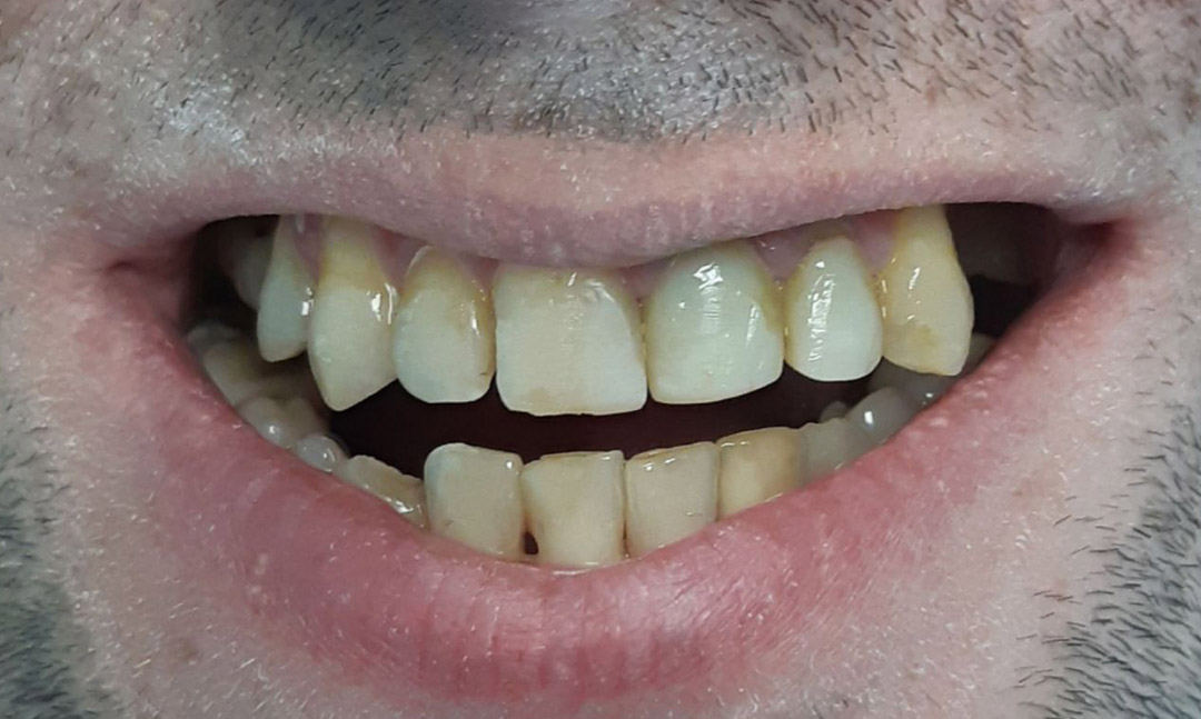 Image before
