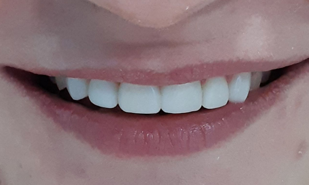 Image after