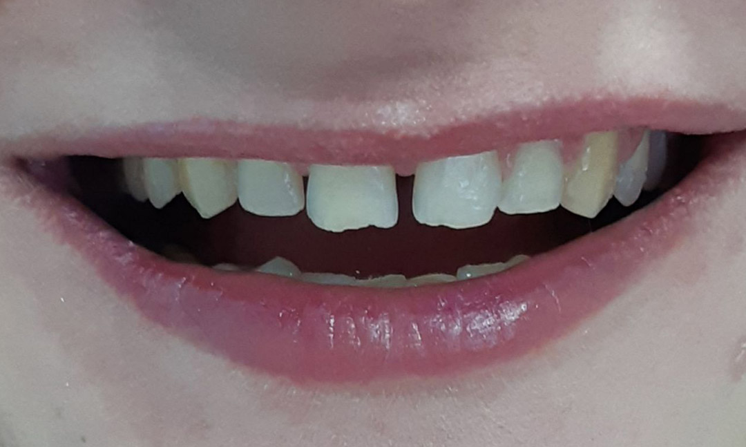 Image before