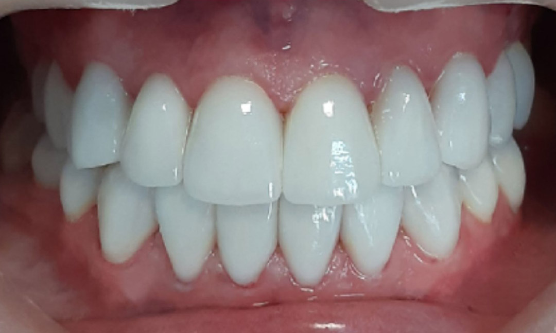 Image after