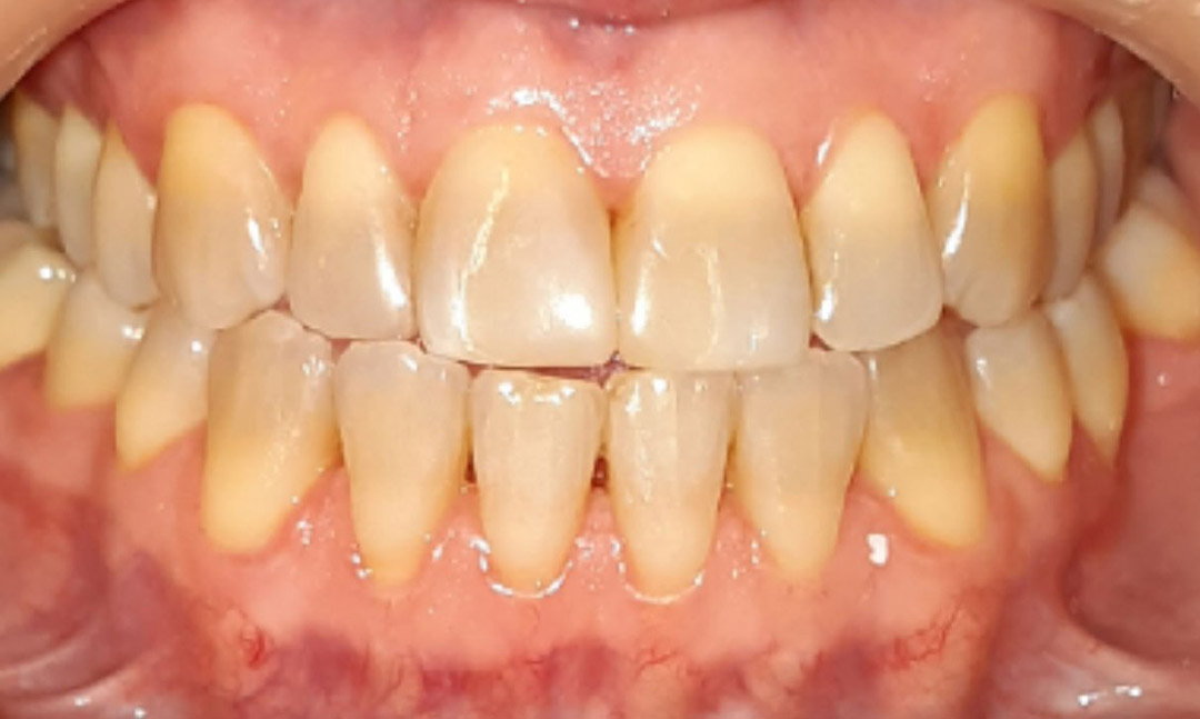 Image before