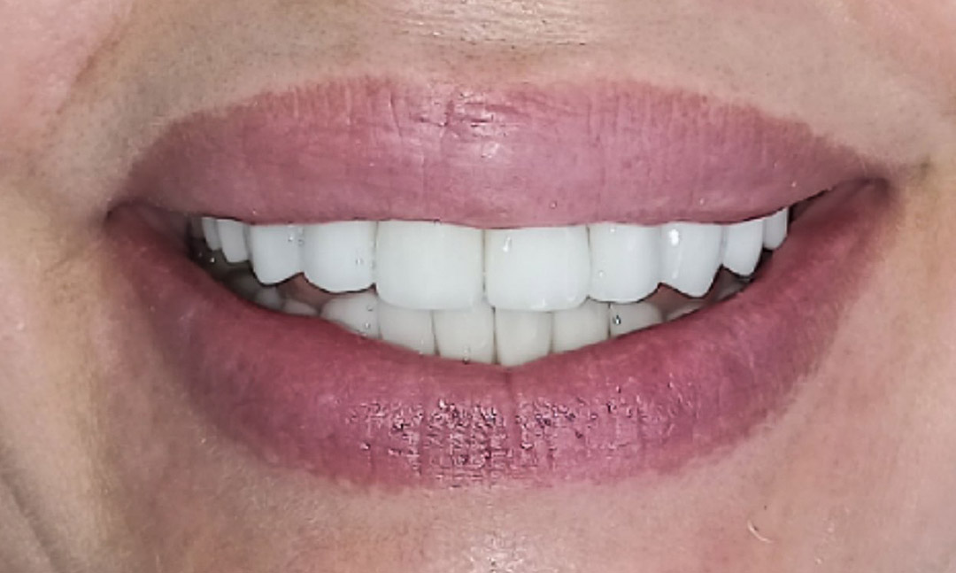 Image after
