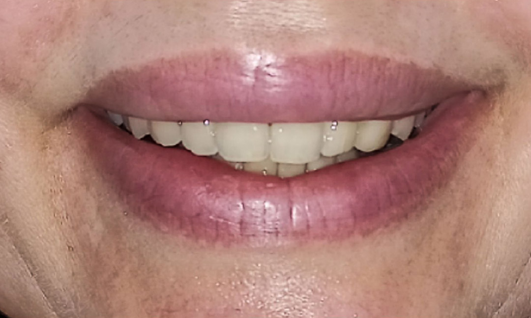 Image before