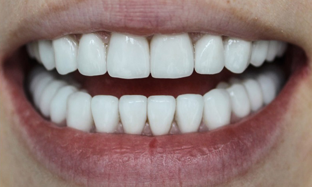Image after