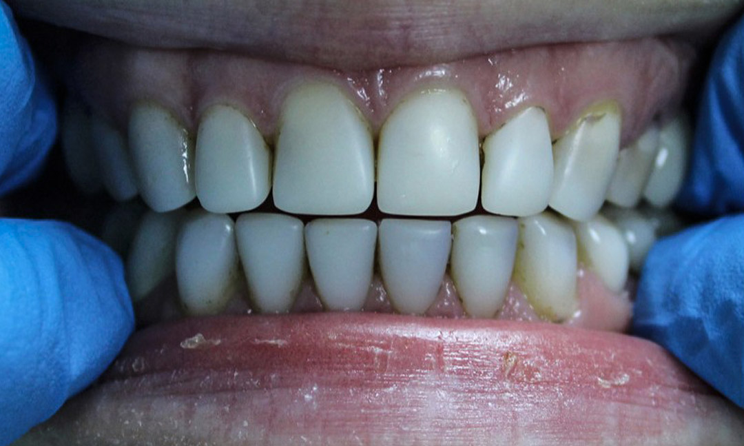 Image before
