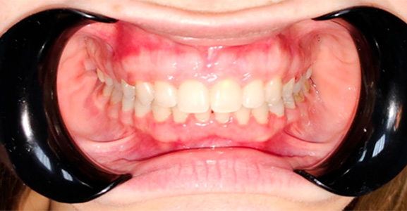 Image after