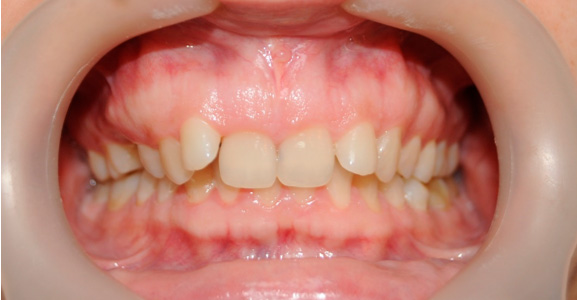 Image before