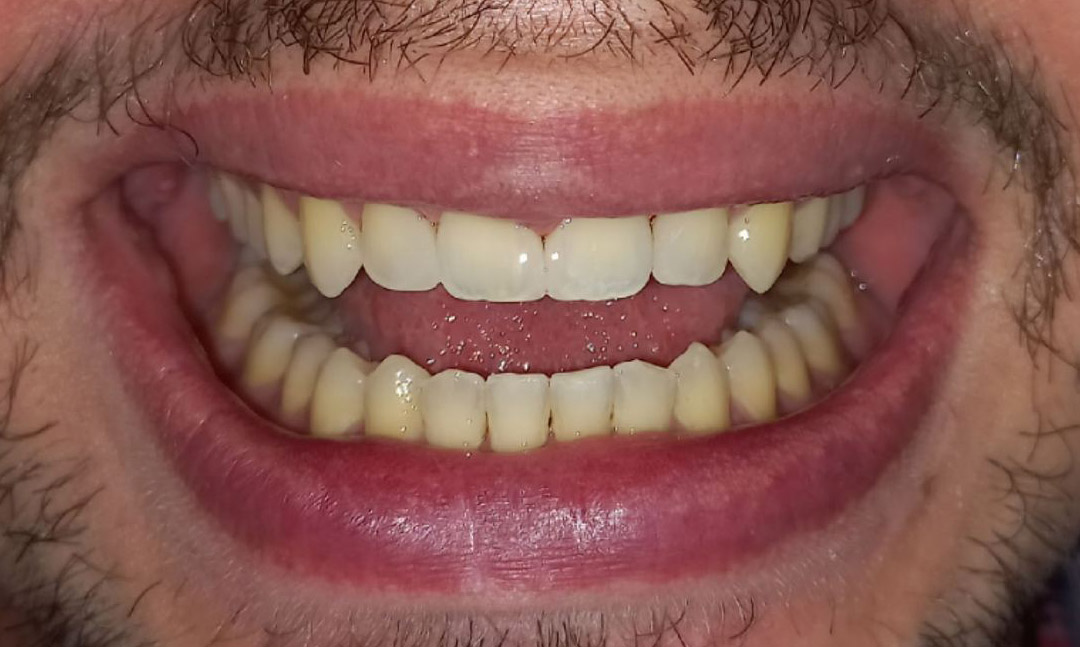 Image after