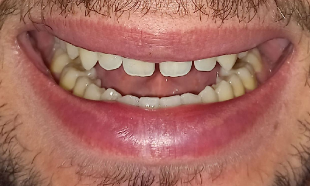 Image before