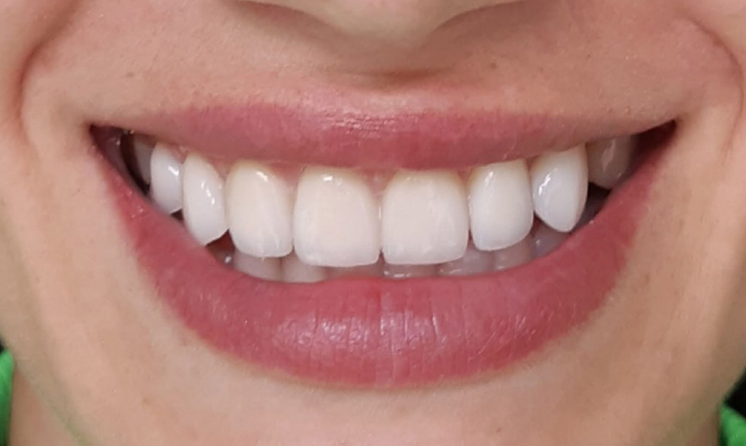 Image after