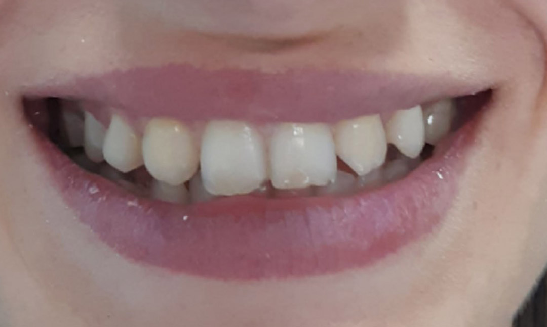 Image before