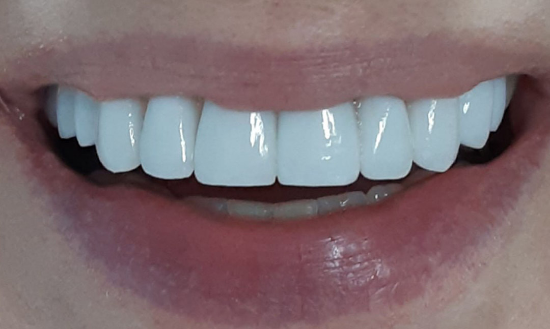 Image after