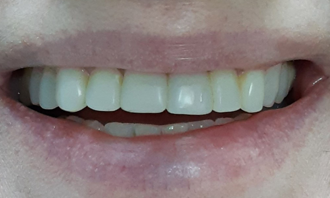 Image before