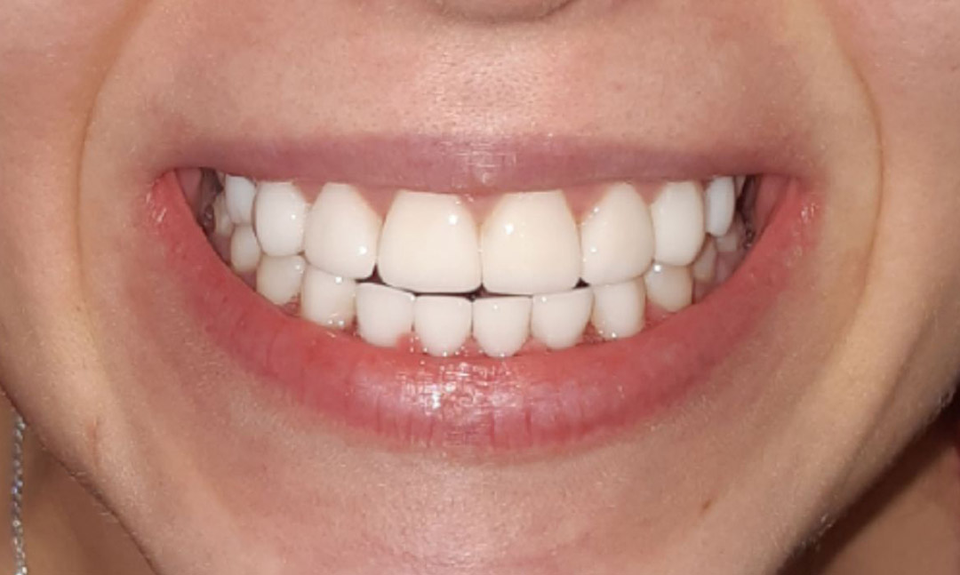 Image after