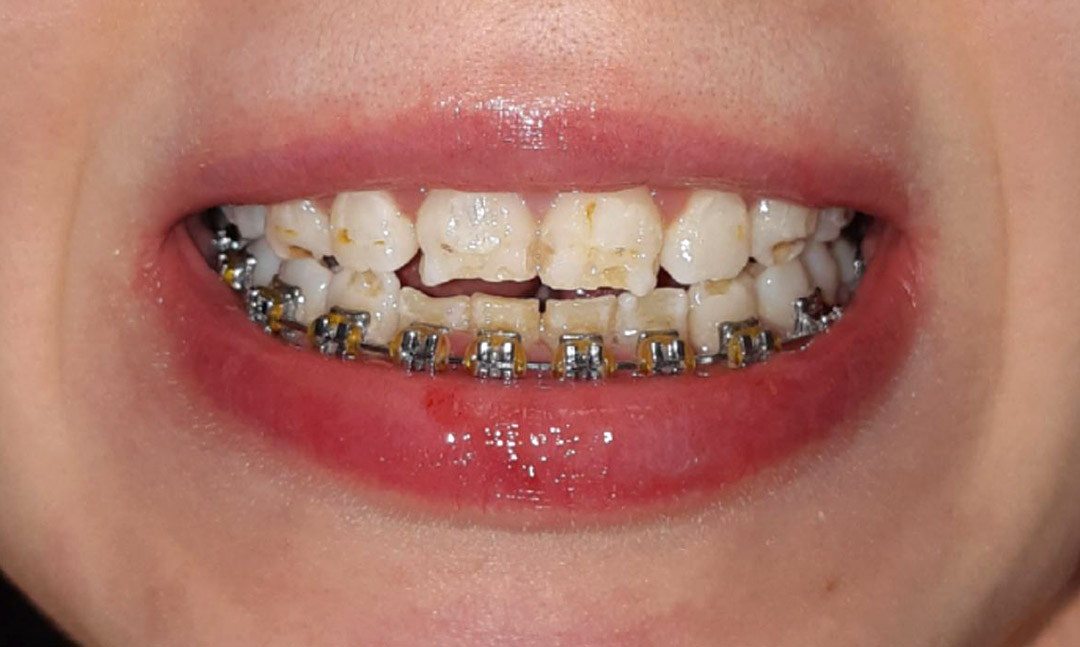 Image before