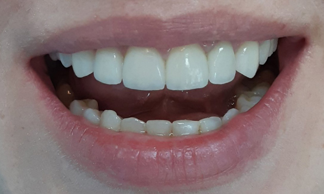 Image after