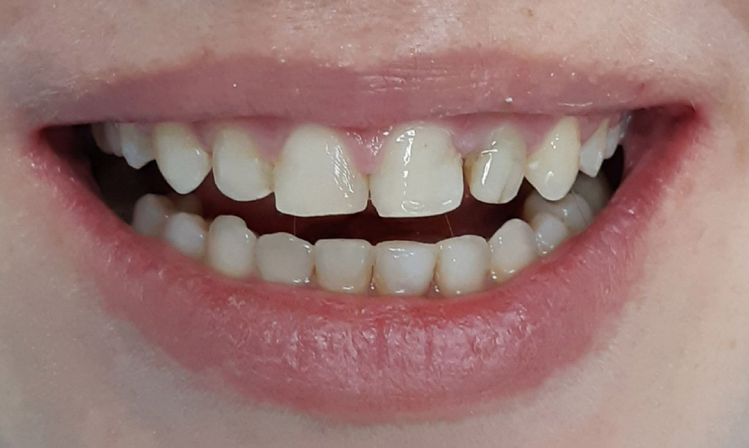 Image before