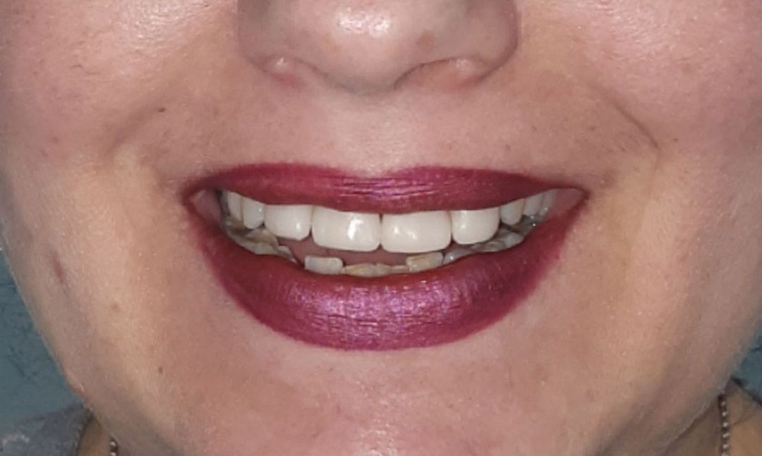 Image after