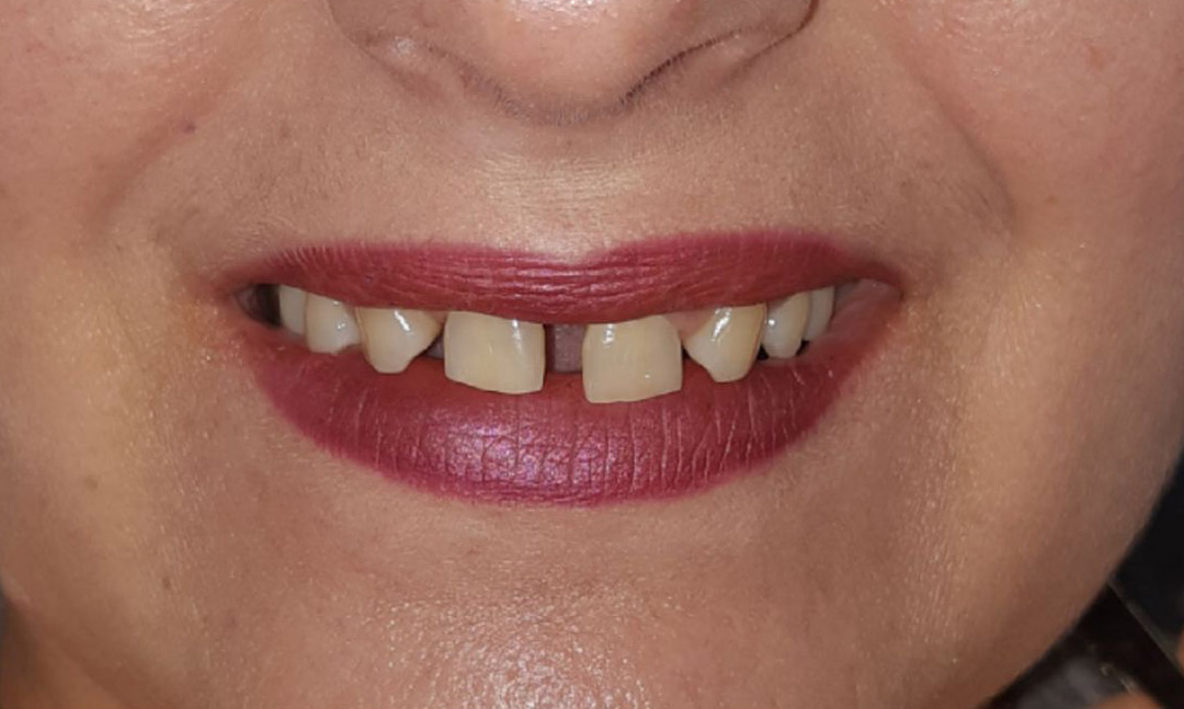 Image before