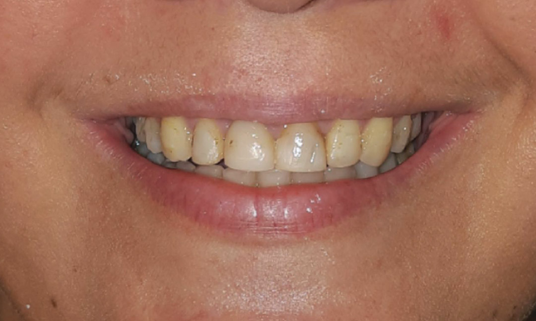 Image before
